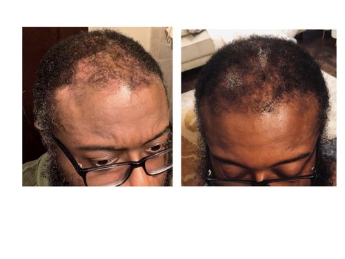 Dev B. review of Chad and India’s Root to Tip Combo. FREE POUF PROTECTOR BONNET INCLUDED image 1 out of 1