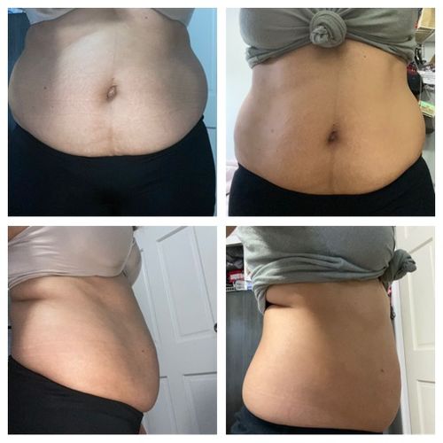 Customer photo review of Awaken and Restore Intensive skin Repair
