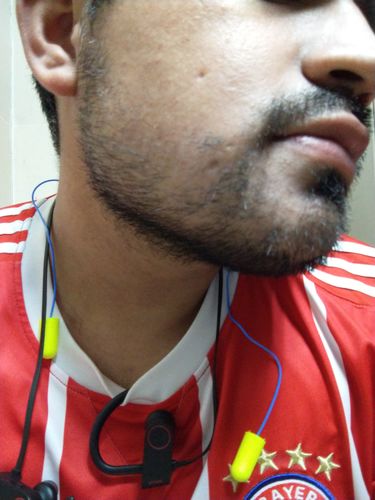 Customer photo review of 12.5% Minoxidil Extra Strength Topical Solution USP for Men.