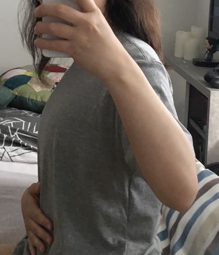 Customer photo review of ACTIVE (NON-Bandage)