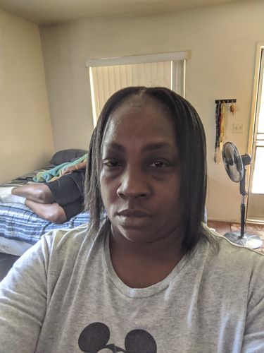 Customer photo review of PureFix Hair Elixir