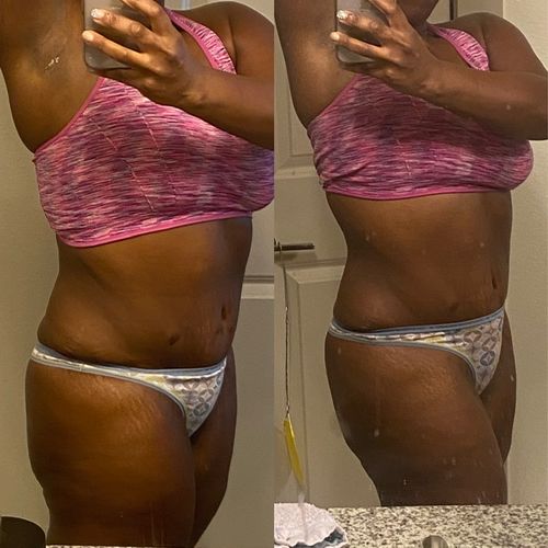Customer photo review of 45 Uses Herbal Magnesium Therapy Wrap: Legs/Core