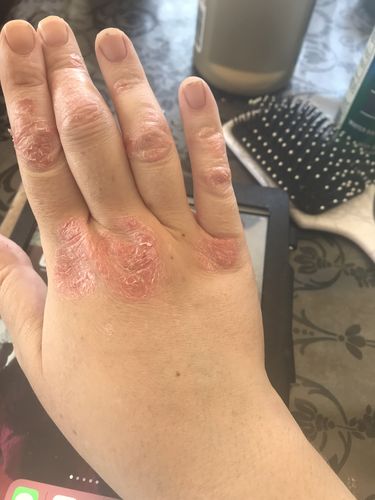 Customer photo review of Milk Thistle Tincture