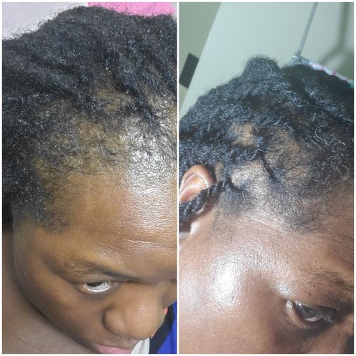 Customer photo review of Nae Nae's 9oz Hair Boost Special