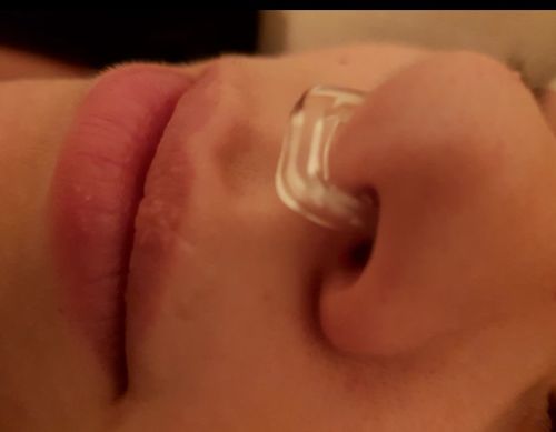 Customer photo review of Schnarchstopper - Schluss mit lästigem Schnarchen