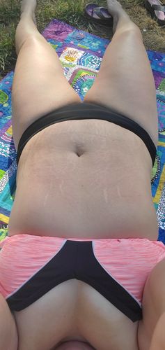 Customer photo review of 15 Uses Magnesium Therapy Herbal Wrap