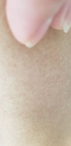 Customer photo review of (BOGO) AWAKEN: Skin Repair Intensive Healing Serum