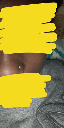 Customer photo review of Square Gem Surgical Steel L-Bend Nose Ring