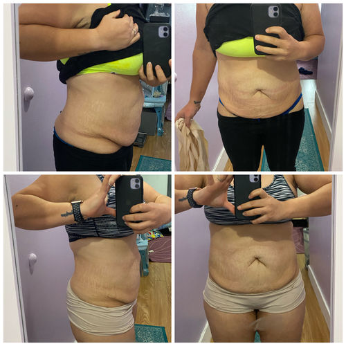 Customer photo review of 15 Uses Magnesium Therapy Herbal Wrap