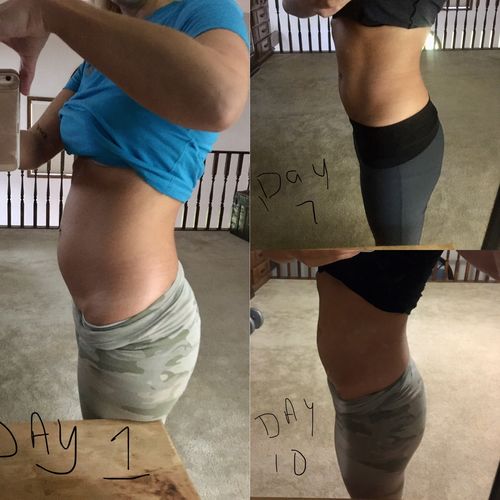 Customer photo review of 15 Uses Magnesium Therapy Herbal Wrap