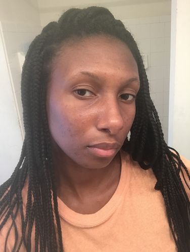 Customer photo review of Misses Clean | Cleansing Foam