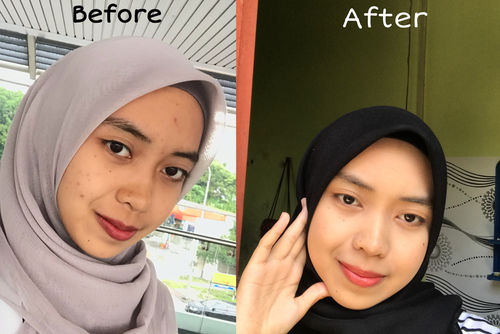Customer photo review of Happiness box Edisi Kemerdekaan - Scar & Treatment set
