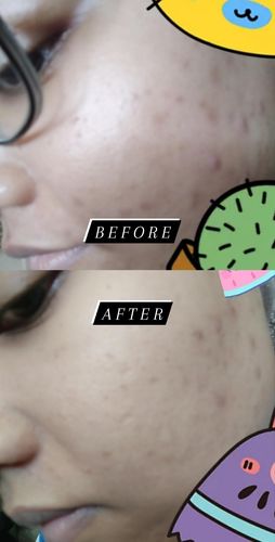 Customer photo review of Teamon scar set