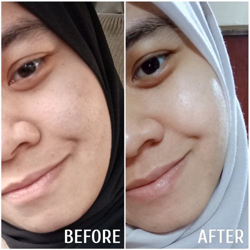 Customer photo review of Teamon scar set