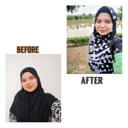 Customer photo review of Teamon treatment set