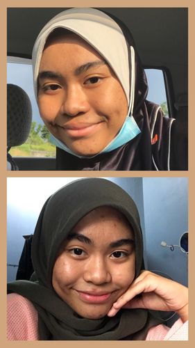 Customer photo review of Teamon brightening set