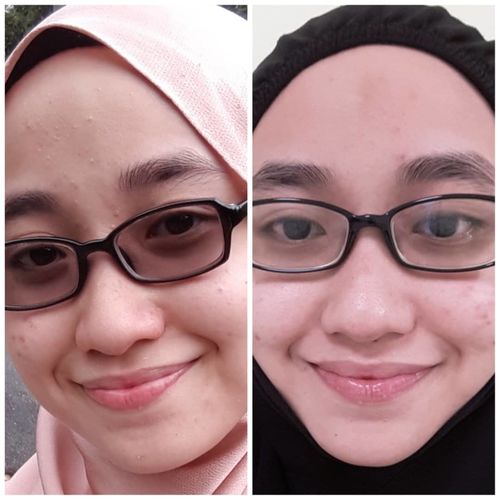 Customer photo review of Teamon brightening set