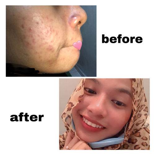 Customer photo review of Teamon brightening set