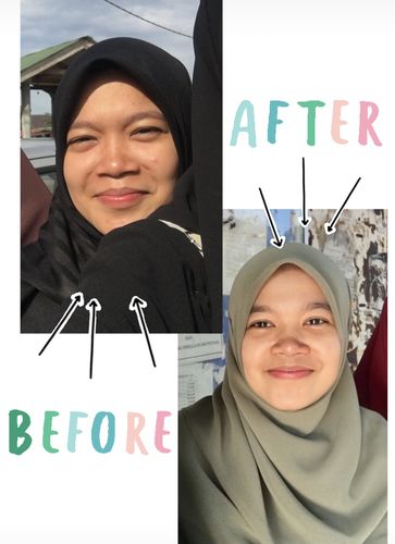 Customer photo review of Teamon treatment set