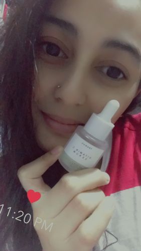 Customer photo review of Teamon scar set