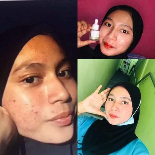 Customer photo review of Teamon vitamin c serum
