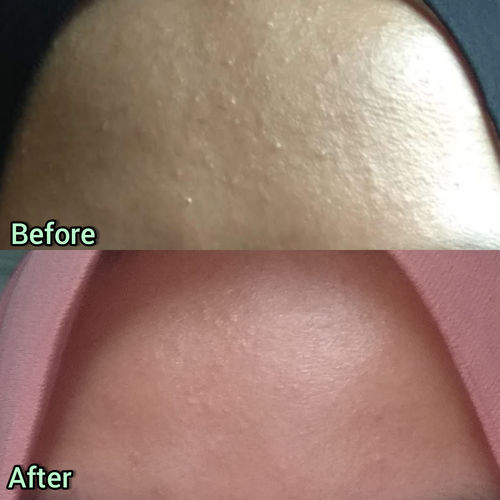 Customer photo review of Teamon cucumber hydration serum