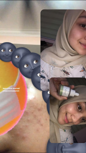 Customer photo review of Teamon Trial Kit
