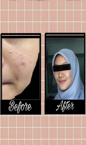 Customer photo review of Teamon treatment set