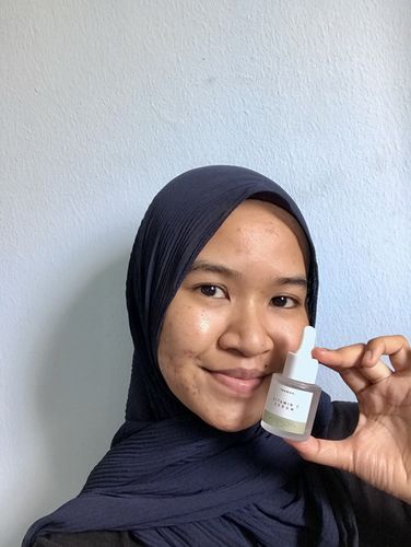 Customer photo review of Teamon scar set