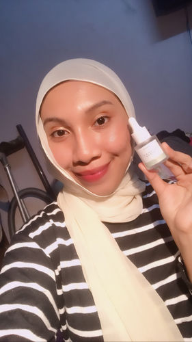 Customer photo review of Teamon scar set