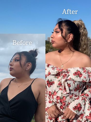 Customer photo review of Jawline Fix: Filler