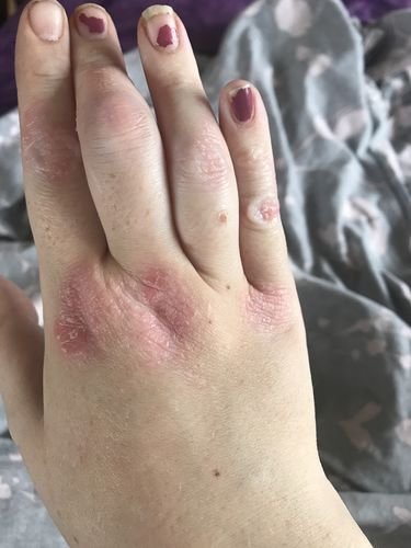 Customer photo review of Milk Thistle Tincture