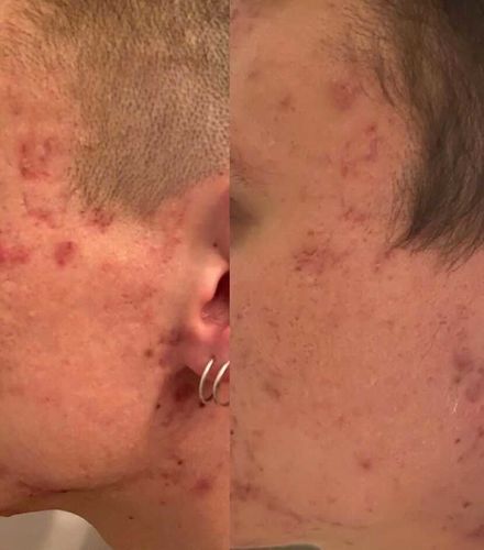 Customer photo review of Radiance Powder