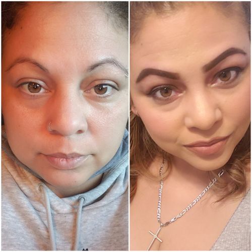 Customer photo review of ILLUMINEYE : Dark circles, Under-eye Puffiness and Saggy Skin