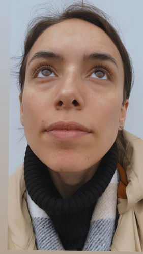 Customer photo review of Lash & Brow Enhancing Serum