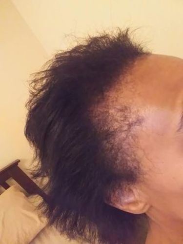 Customer photo review of PureFix Hair Elixir