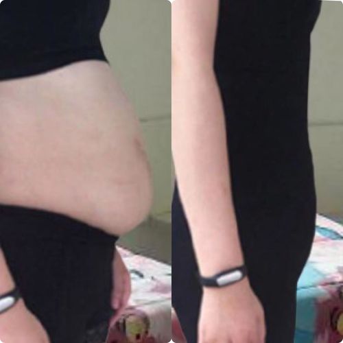 Customer photo review of Body Perfect (Cod. 1934529367)