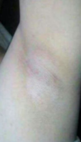 Customer photo review of TOP DEO CREAM PROMO PACKAGE