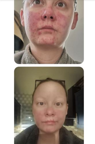 Customer photo review of Repair and Renew Cream