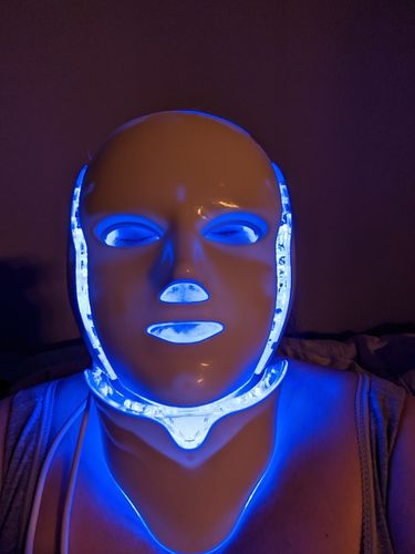 Customer photo review of Everything Beauty™ Professional LED Light Therapy Mask