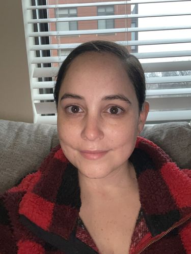 Customer photo review of GLO•ROLL Filter Facial System