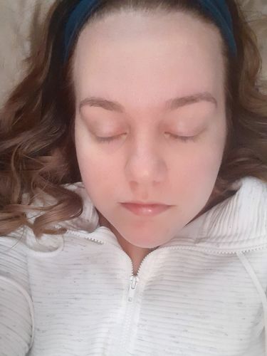 Customer photo review of (BOGO) AWAKEN: Skin Repair Intensive Healing Serum