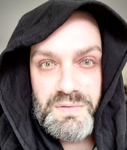 Customer photo review of New York Angeles Grey Contact Lenses