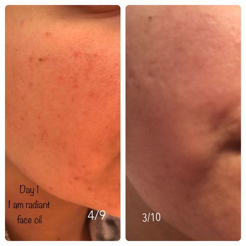 Customer photo review of I AM RADIANT Facial oil