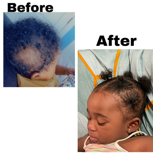 Customer photo review of Kid's Super healthy Hair kit
