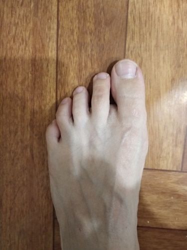 Customer photo review of Attelle correctrice d'oignons