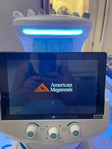 Customer photo review of 7 in 1 Intelligent Skin Analyzer Hydrafacial Machine