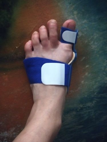 Customer photo review of Attelle correctrice d'oignons