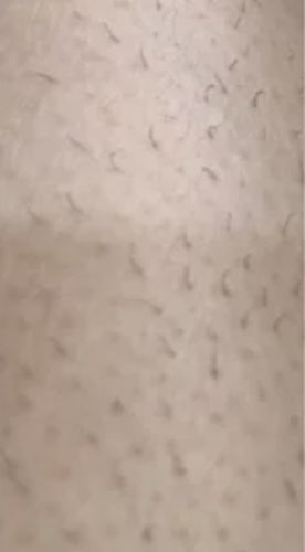 Customer photo review of WONDER SKIN HAIR REMOVAL ORGINAL CLASSIC PRO