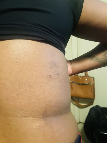 Customer photo review of Latex Zip + Clip